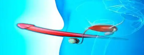 True secret of overcoming male infertility and secual weakness in a man